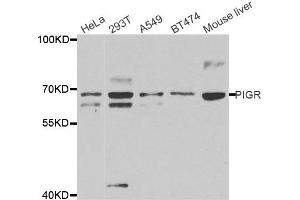 Western Blotting (WB) image for anti-Polymeric Immunoglobulin Receptor (PIGR) antibody (ABIN1877116) (PIGR antibody)