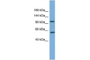 WB Suggested Anti-PI4KB Antibody Titration: 0. (PI4KB antibody  (Middle Region))