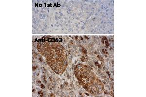 Immunohistochemistry (IHC) image for anti-CD63 (CD63) (AA 120-175) antibody (ABIN1440014)