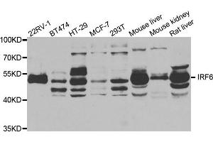 Western Blotting (WB) image for anti-Interferon Regulatory Factor 6 (IRF6) antibody (ABIN1882373) (IRF6 antibody)