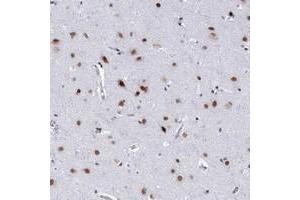 Immunohistochemical staining of human cerebral cortex with SF3B14 polyclonal antibody  shows strong nuclear positivity in neuronal cells at 1:50-1:200 dilution. (Pre-mRNA Branch Site Protein p14 (SF3B14) antibody)