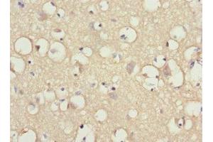 Immunohistochemistry of paraffin-embedded human brain tissue using ABIN7156711 at dilution of 1:100 (IFRD1 antibody  (AA 1-240))