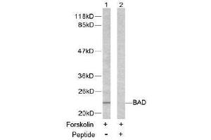 Image no. 2 for anti-BCL2-Associated Agonist of Cell Death (BAD) (Ser155) antibody (ABIN197212)
