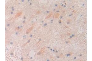 Immunohistochemistry (IHC) image for anti-Chordin (CHRD) (AA 700-918) antibody (ABIN7442051)