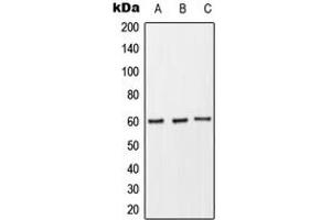 Western blot analysis of CD89 expression in THP1 (A), Raw264. (FCAR antibody  (Center))