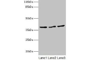 Western blot All lanes: CRYZL1 antibody at 12 μg/mL Lane 1: Hela whole cell lysate Lane 2: HepG2 whole cell lysate Lane 3: Jurkat whole cell lysate Secondary Goat polyclonal to rabbit IgG at 1/10000 dilution Predicted band size: 39, 22 kDa Observed band size: 39 kDa (CRYZL1 antibody  (AA 1-87))