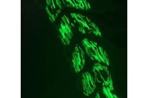 Image no. 2 for anti-Actin, alpha 1, Skeletal Muscle (ACTA1) antibody (ABIN1502284) (Actin antibody)