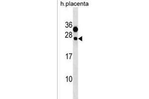 CLEC6A Antibody (C-term) (ABIN1536706 and ABIN2850181) western blot analysis in human placenta tissue lysates (35 μg/lane). (C-Type Lectin Domain Family 6, Member A (CLEC6A) (AA 137-163), (C-Term) antibody)