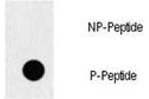Dot blot analysis of p-EGFR antibody. (EGFR antibody  (pTyr1069))