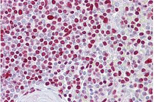 Immunohistochemistry (IHC) image for anti-Atonal Homolog 1 (Drosophila) (ATOH1) (Middle Region) antibody (ABIN2779592) (ATOH1 antibody  (Middle Region))