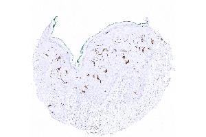 Strong CD1 immunostaining of Langerhans cells in squamous epithelium of the skin (Recombinant CD1a antibody)