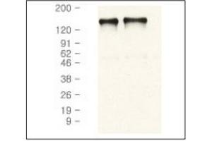 Western Blotting (WB) image for anti-Epidermal Growth Factor Receptor (EGFR) antibody (ABIN371623) (EGFR antibody)