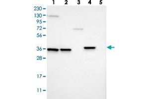 Western blot analysis of Lane 1: RT-4, Lane 2: U-251 MG, Lane 3: Human Plasma, Lane 4: Liver, Lane 5: Tonsil with MARC2 polyclonal antibody .