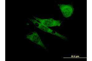 Immunofluorescence of monoclonal antibody to SCN8A on NIH/3T3 cell. (SCN8A antibody  (AA 1854-1951))