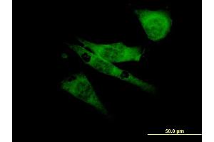 Immunofluorescence of monoclonal antibody to SCN8A on NIH/3T3 cell. (SCN8A antibody  (AA 1854-1951))