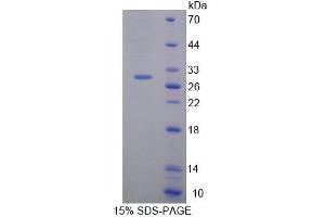 SDS-PAGE analysis of Mouse HAND1 Protein. (HAND1 Protein)