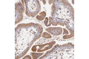 Immunohistochemical staining of human placenta with BGN polyclonal antibody  strong cytoplasmic positivity in trophoblastic cells. (Biglycan antibody)