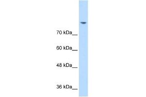 WB Suggested Anti-DLG2 Antibody Titration:  0.