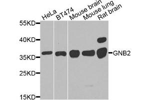 Western blot analysis of extracts of various cells, using GNB2 antibody. (GNB2 antibody)