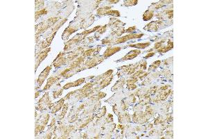Immunohistochemistry of paraffin-embedded mouse heart using SLC25 antibody (ABIN7270430) at dilution of 1:100 (40x lens).