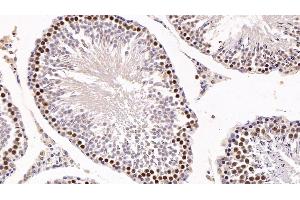 Detection of KPNa2 in Rat Testis Tissue using Polyclonal Antibody to Karyopherin Alpha 2 (KPNa2) (KPNA2 antibody  (AA 157-412))