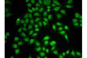Immunofluorescence analysis of MCF-7 cell using PSMB9 antibody. (PSMB9 antibody  (AA 1-219))