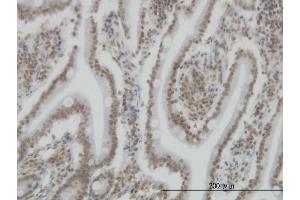 Immunoperoxidase of monoclonal antibody to SP110 on formalin-fixed paraffin-embedded human small Intestine. (SP110 antibody  (AA 271-380))
