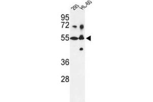 Western Blotting (WB) image for anti-Cytochrome P450, Family 21, Subfamily A, Polypeptide 2 (CYP21A2) antibody (ABIN3003551)