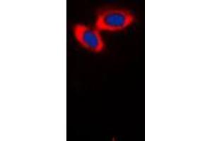 Immunofluorescent analysis of CD3d staining in Jurkat cells. (CD3D antibody  (Center))