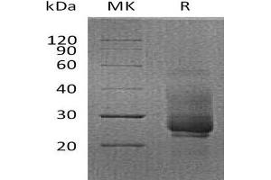 Hepatitis A Virus Cellular Receptor 2 (TIM 3) protein (His tag)
