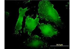 Immunofluorescence of monoclonal antibody to MAGI1 on HeLa cell. (MAGI1 antibody  (AA 761-859))