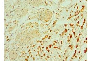 Immunohistochemistry of paraffin-embedded human epityphlon tissue using ABIN7164900 at dilution of 1:100 (TAC1 antibody  (AA 1-129))