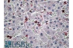 ABIN570794 (6µg/ml) staining of paraffin embedded Human Liver. (CCL20 antibody  (Internal Region))