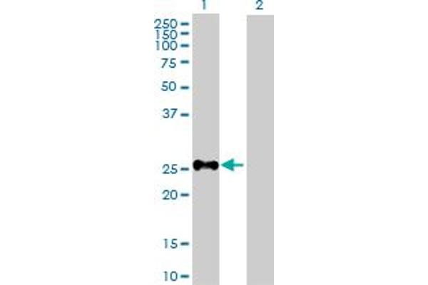 SHOX antibody  (AA 1-225)