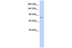 WB Suggested Anti-EVI1 Antibody Titration: 0. (MECOM antibody  (N-Term))