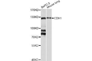 Western blot analysis of extracts of various cell lines, using CDH1 antibody (ABIN5971558) at 1/1000 dilution. (E-cadherin antibody)
