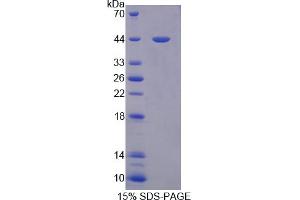 Image no. 1 for Persephin (PSPN) (AA 29-156) protein (His tag,GST tag) (ABIN6236838) (Persephin Protein (PSPN) (AA 29-156) (His tag,GST tag))