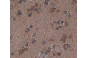 IHC-P analysis of Human Tissue, with DAB staining. (NMDAR2A antibody  (AA 31-555))