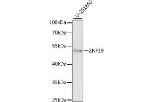 Western blot analysis of extracts of U-251MG cells, using ZNF19 antibody (ABIN7271464) at 1:1000 dilution. (ZNF19 antibody  (AA 1-180))
