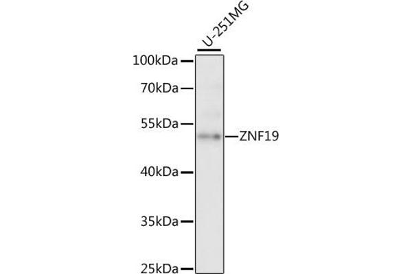 ZNF19 Antikörper  (AA 1-180)