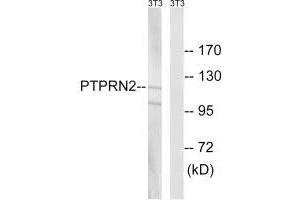 Western blot analysis of extracts from NIH/3T3 cells, using PTPRN2 antibody.