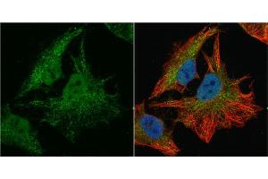ICC/IF Image SOD1 antibody detects SOD1 protein at cytoplasm and nucleus by immunofluorescent analysis.