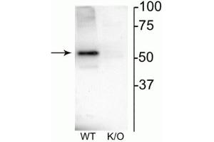 Western blot of mouse habenula lysate showing specific immunolabeling of the ~52 kDa nAChRβ4 protein.