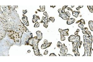 IHC analysis of CDC123 using anti-CDC123 antibody (ABIN7599284). (CDC123 antibody  (AA 1-336))