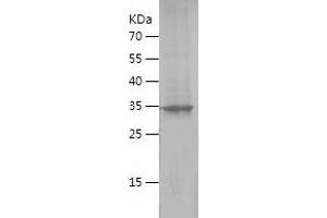 Western Blotting (WB) image for Myeloma Overexpressed (MYEOV) (AA 50-169) protein (His-IF2DI Tag) (ABIN7283313) (MYEOV Protein (AA 50-169) (His-IF2DI Tag))