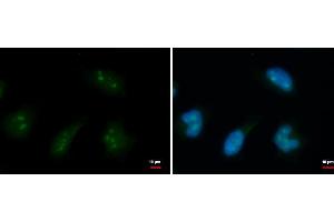 ICC/IF Image DDX18 antibody detects DDX18 protein at nucleolus by immunofluorescent analysis. (DDX18 antibody  (Center))