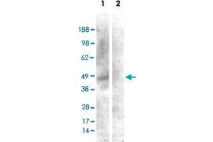 HEK293 overexpressing CNR1 and probed with CNR1 polyclonal antibody  (mock transfection in second lane), tested by Origene.