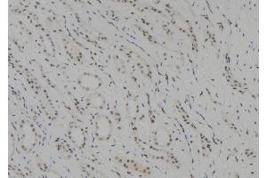 ABIN6278405 at 1/100 staining Human kidney tissue by IHC-P. (SUV39H1 antibody  (C-Term))