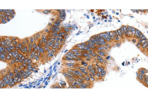 KCNC2 antibody