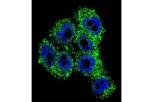 Immunofluorescence (IF) image for anti-Transient Receptor Potential Cation Channel, Subfamily M, Member 8 (TRPM8) antibody (ABIN2996363) (TRPM8 antibody)